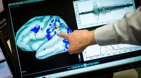 Brain Injuries & Personal Injury Claims